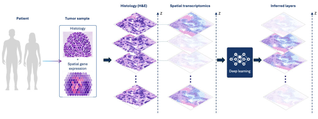 Diagram showing patient tumour sample analysed by histology and spatial gene expression, layered with spatial transcriptomics, then processed by deep learning to infer tissue layers.