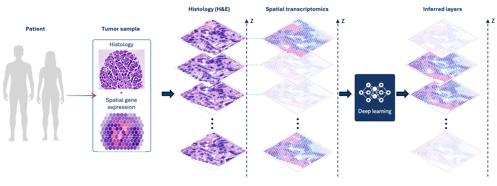 Diagram showing patient tumour sample analysed by histology and spatial gene expression, layered with spatial transcriptomics, then processed by deep learning to infer tissue layers.