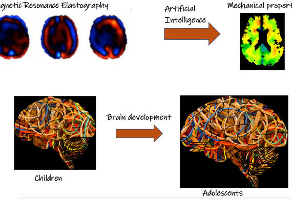 Characterization of the mechanical tissue properties of the brain in the developing brain with magnetic resonance elastography