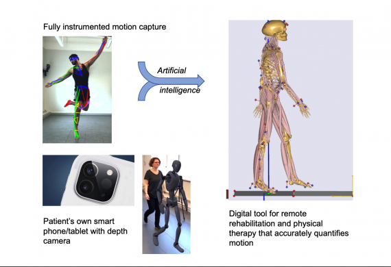 Deep Camera-Based Movement Analysis for Remote Rehabilitation and Physical Therapy